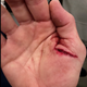Illustration for article titled Tom Brady Reveals That His Thumb Injury Was Gross